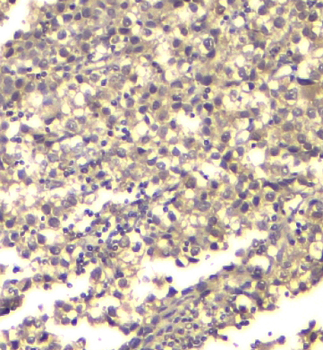 Anti-ATP citrate lyase ACLY Antibody (monoclonal, 5I2)