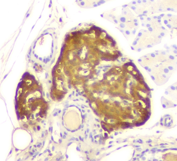 Anti-ATP citrate lyase ACLY Antibody (monoclonal, 5I2)