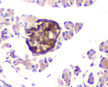 Anti-ATP citrate lyase ACLY Antibody (monoclonal, 5I2)