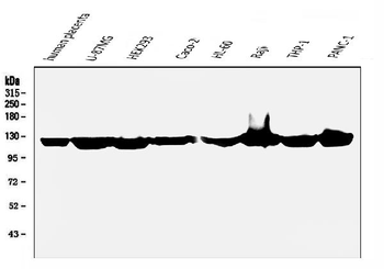 Anti-ATP citrate lyase ACLY Antibody (monoclonal, 5I2)