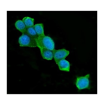 ATP citrate lyase ACLY Antibody (monoclonal, 5I2)
