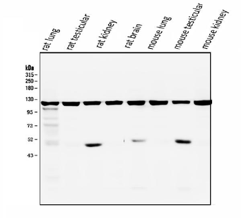 Anti-ATP citrate lyase ACLY Antibody (monoclonal, 5I2)