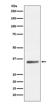 SIRT5/Sirtuin 5 Rabbit Monoclonal Antibody