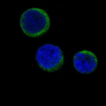 Anti-Ferritin FTH1 Rabbit Monoclonal Antibody