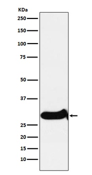 IGFBP7 Monoclonal Antibody