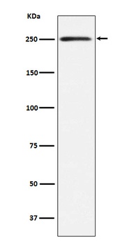 MYH11 Rabbit Monoclonal Antibody