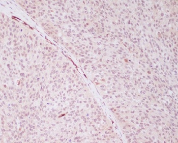 PRP19 PRPF19 Rabbit Monoclonal Antibody
