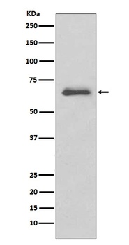 IRAK3/Irak M Rabbit Monoclonal Antibody