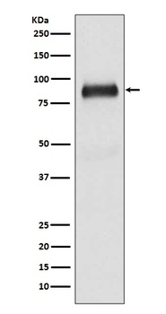 Anti-SATB2 Rabbit Monoclonal Antibody