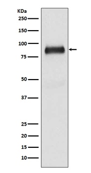 SATB2 Rabbit Monoclonal Antibody