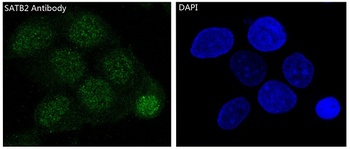 Anti-SATB2 Rabbit Monoclonal Antibody