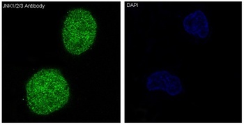 JNK1/2/3 MAPK8 Rabbit Monoclonal Antibody