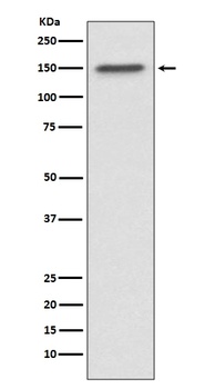 ASPP2 Rabbit Monoclonal Antibody