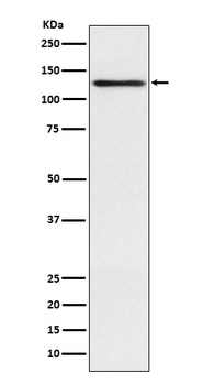 Involucrin IVL Rabbit Monoclonal Antibody