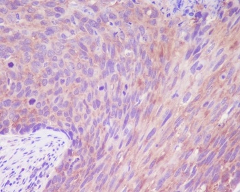 DSG1/Desmoglein 1 Rabbit Monoclonal Antibody