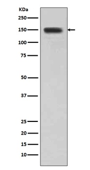 DSG1/Desmoglein 1 Rabbit Monoclonal Antibody