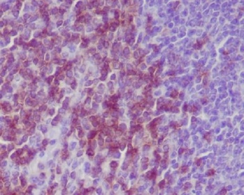 CD3 epsilon Rabbit Monoclonal Antibody