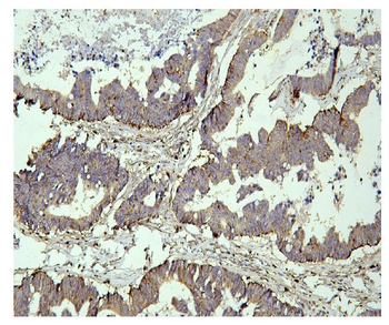 Anti-PPT1 Antibody (monoclonal, 10F3)