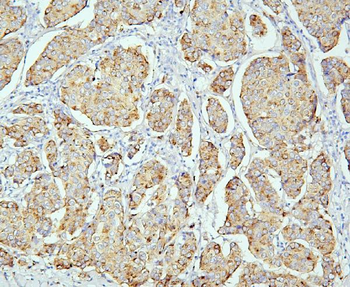 Anti-PPT1 Antibody (monoclonal, 10F3)