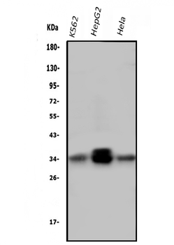 Anti-PPT1 Antibody (monoclonal, 10F3)