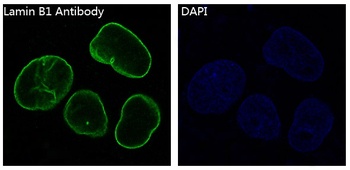 Anti-Lamin B1 LMNB1 Rabbit Monoclonal Antibody