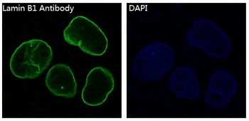 Lamin B1 LMNB1 Rabbit Monoclonal Antibody