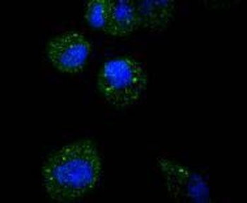 ATF5 Rabbit Monoclonal Antibody