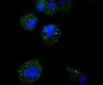 Anti-ATF5 Rabbit Monoclonal Antibody