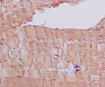 Anti-Myosin heavy chain MYH6 Rabbit Monoclonal Antibody