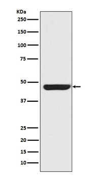 Anti-Cytokeratin 20 KRT20 Rabbit Monoclonal Antibody