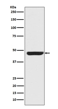 Cytokeratin 20 KRT20 Rabbit Monoclonal Antibody