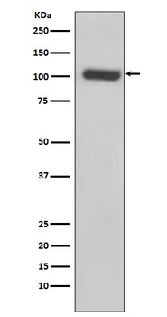 PSMA FOLH1 Rabbit Monoclonal Antibody