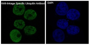K48-linkage Specific Ubiquitin UBB Rabbit Monoclonal Antibody