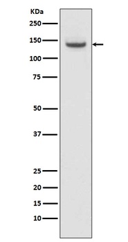 Anti-TACC3 Rabbit Monoclonal Antibody