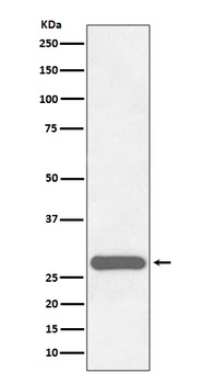 CITED2 Rabbit Monoclonal Antibody