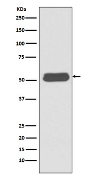 LSP1 Rabbit Monoclonal Antibody