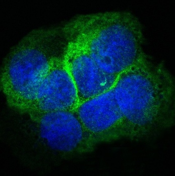 Anti-Collagen XVII Rabbit Monoclonal Antibody