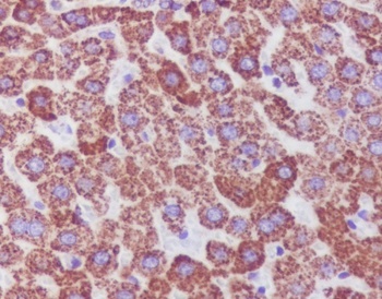 Catalase Rabbit Monoclonal Antibody