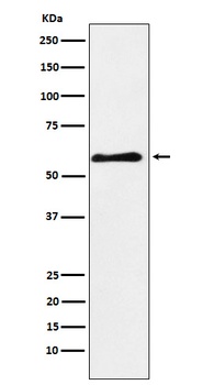 PAK3 Rabbit Monoclonal Antibody
