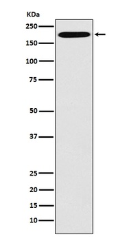 Clathrin heavy chain Rabbit Monoclonal Antibody