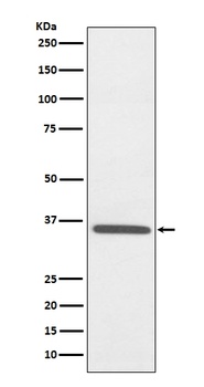 Fibrillarin FBL Rabbit Monoclonal Antibody