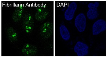 Fibrillarin FBL Rabbit Monoclonal Antibody