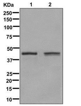 Glutamine Synthetase GLUL Rabbit Monoclonal Antibody