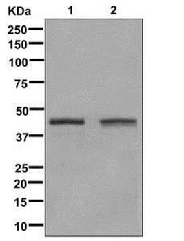 Anti-Glutamine Synthetase GLUL Rabbit Monoclonal Antibody