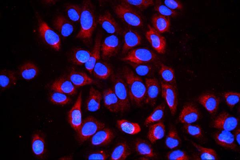Anti-Cyclophilin B PPIB Antibody (monoclonal, 11C11)