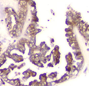 Anti-Cyclophilin B PPIB Antibody (monoclonal, 11C11)