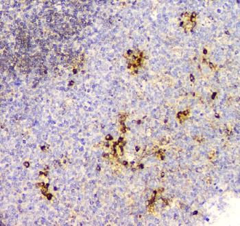 Anti-Cyclophilin B PPIB Antibody (monoclonal, 11C11)