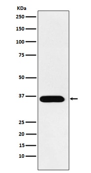 TRAP ACP5 Rabbit Monoclonal Antibody