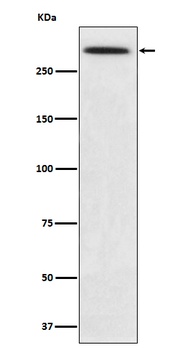 SPTA1 Rabbit Monoclonal Antibody