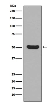 Cytokeratin 16 KRT16 Rabbit Monoclonal Antibody